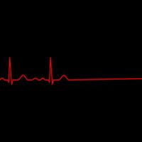 EKG_End EKG_End
